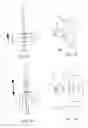 Fig. 08 - Methods and devices for combined gastric restriction and electrical stimulation