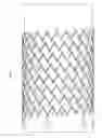 Fig. 07 - Stent and method for manufacturing the stent