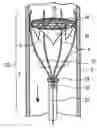 Fig. 01 - Method of treatment and devices for the treatment of left ventricular failure