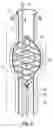 Fig. 09 - Method of treatment and devices for the treatment of left ventricular failure