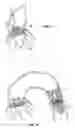 Fig. 07 - Method and apparatus for percutaneous valve repair