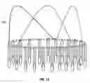 Fig. 09 - Method and apparatus for percutaneous valve repair