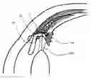 Fig. 01 - Intraocular device for the restoring visual accommodation of presbiopic eye