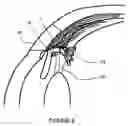 Fig. 07 - Intraocular device for the restoring visual accommodation of presbiopic eye