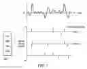 Fig. 07 - Methods, devices and systems for improved codebook search for voice codecs
