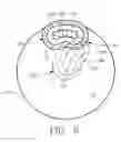 Fig. 07 - Magnetron having continuously variable radial position