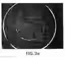 Fig. 04 - Pad transfer printing method for making colored contact lenses
