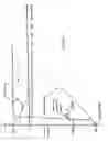 Fig. 10 - Phacoemulsification machine with post-occlusion surge control system and related method