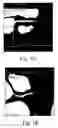Fig. 02 - Apparatus and method for analysis of tissue classes along tubular structures