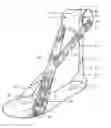 Fig. 01 - Ankle brace