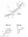 Fig. 02 - Movable inflatable anchor for medical devices