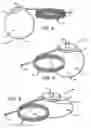 Fig. 03 - Corporeal drainage system