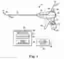 Fig. 02 - Transurethral needle ablation system with flexible catheter tip