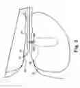 Fig. 03 - Transurethral needle ablation system with flexible catheter tip