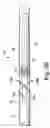 Fig. 05 - Transurethral needle ablation system with flexible catheter tip