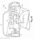 Fig. 08 - Transurethral needle ablation system with flexible catheter tip