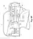 Fig. 09 - Transurethral needle ablation system with flexible catheter tip