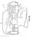 Fig. 10 - Transurethral needle ablation system with flexible catheter tip