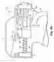 Fig. 11 - Transurethral needle ablation system with flexible catheter tip