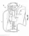 Fig. 13 - Transurethral needle ablation system with flexible catheter tip
