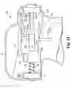 Fig. 16 - Transurethral needle ablation system with flexible catheter tip
