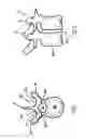Fig. 02 - Adjustable tandem connectors for corrective devices for the spinal column and other bones and joints