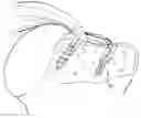 Fig. 01 - Multirow knotless suture anchor assembly