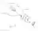 Fig. 08 - Multirow knotless suture anchor assembly