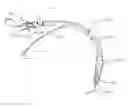 Fig. 01 - Intubation device