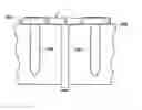 Fig. 01 - Snap-off surgical screw