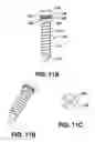 Fig. 08 - Snap-off surgical screw