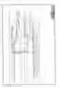 Fig. 197 - Radio frequency data communications device