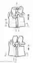 Fig. 03 - Devices and methods for the treatment of spinal disorders