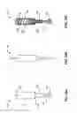 Fig. 11 - Devices and methods for the treatment of spinal disorders