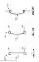 Fig. 13 - Devices and methods for the treatment of spinal disorders