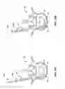 Fig. 17 - Devices and methods for the treatment of spinal disorders