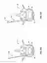 Fig. 18 - Devices and methods for the treatment of spinal disorders