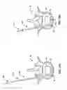 Fig. 19 - Devices and methods for the treatment of spinal disorders