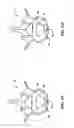 Fig. 20 - Devices and methods for the treatment of spinal disorders
