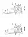 Fig. 23 - Devices and methods for the treatment of spinal disorders