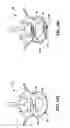 Fig. 24 - Devices and methods for the treatment of spinal disorders