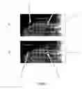 Fig. 02 - Devices and methods for interlocking surgical screws and nails
