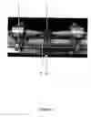 Fig. 14 - Devices and methods for interlocking surgical screws and nails