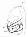 Fig. 01 - Lumbar support with supplemental abdominal support panels