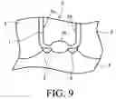 Fig. 07 - Trench gate semiconductor device with a reduction in switching loss