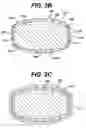 Fig. 09 - Dosage forms having a microreliefed surface and methods and apparatus for their production