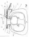Fig. 06 - Retractor for performing heart and thorax surgeries