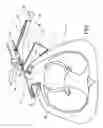 Fig. 07 - Retractor for performing heart and thorax surgeries