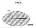 Fig. 06 - Image generating device for generating a fluorescence image