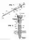 Fig. 02 - Aspiration needle with venting feature